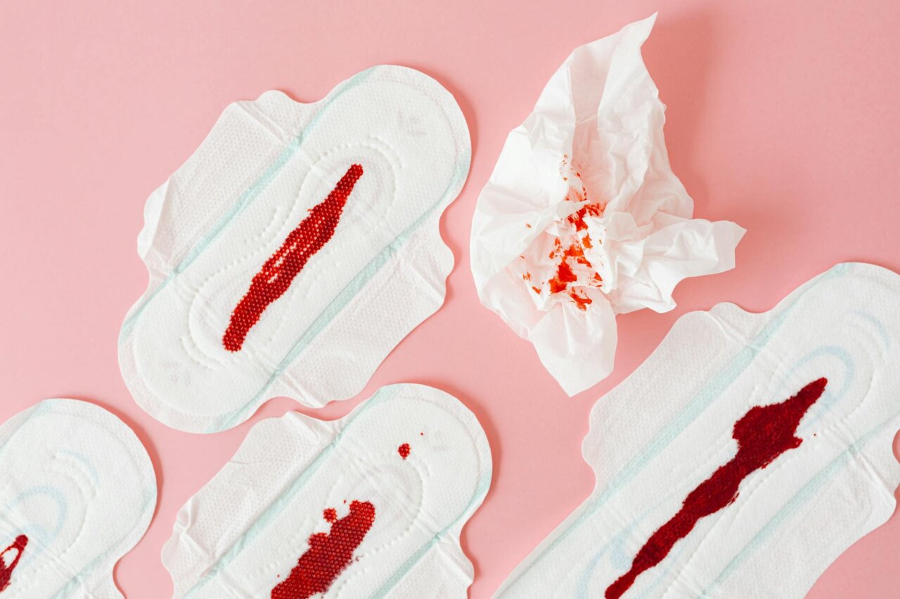 A group of women gathers in a community center, engaging in a discussion about adenomyosis and sharing personal experiences to raise awareness about the condition.