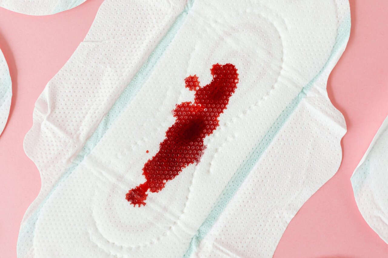 A visual representation of medical research articles and educational materials focused on adenomyosis, highlighting the need for increased awareness and funding
